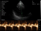 Ultrasonido 3 en 1 Inalámbrico C4PL
